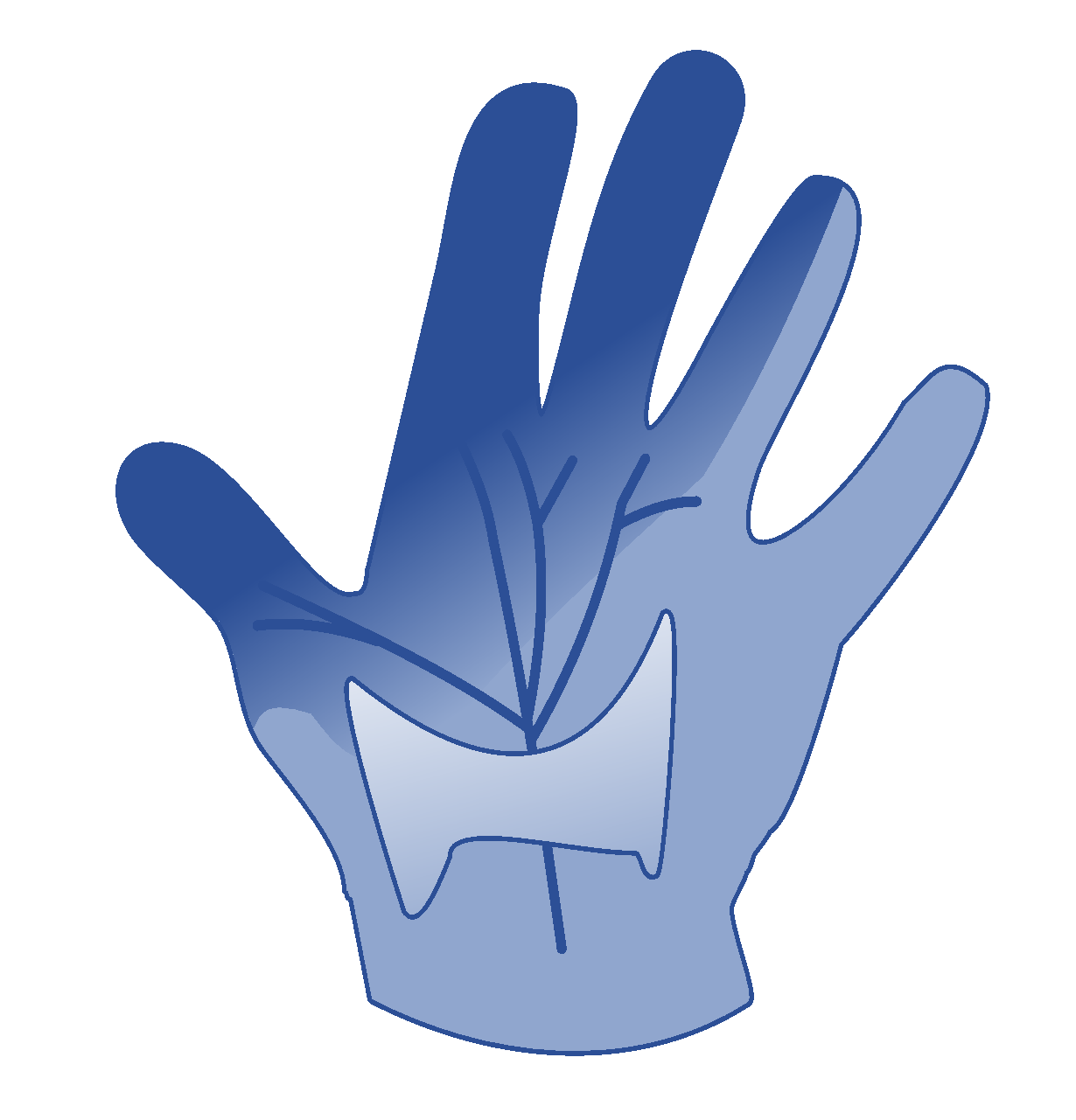 CTS, similar to HVAS caused by using vibrating machinery CTS, similar to HVAS caused by using vibrating machinery